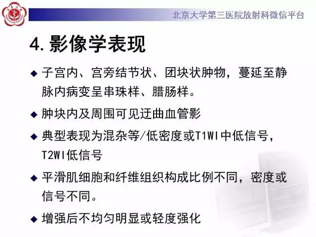 【病例】静脉内平滑肌瘤病1例CT及MR