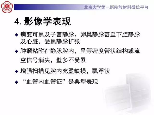 【病例】静脉内平滑肌瘤病1例CT及MR
