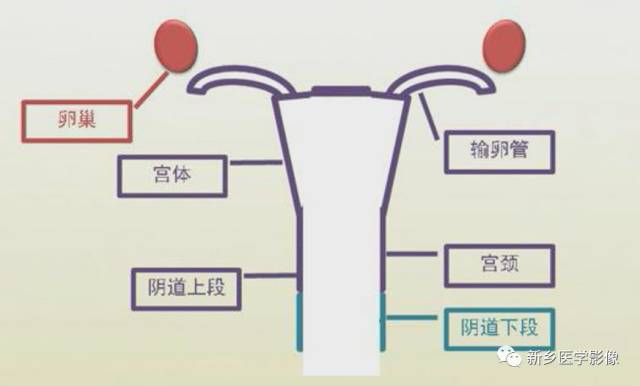阴道发育异常,应想到的5类畸形 阴道发育异常,应想到的5类畸形