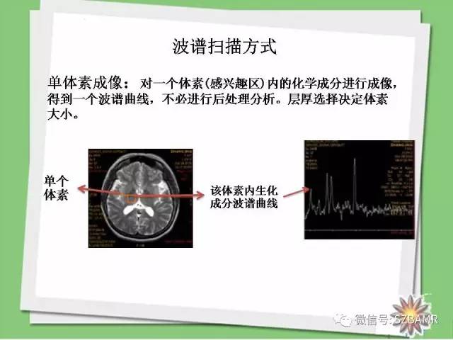 【PPT】波谱扫描技术及病例图片展示