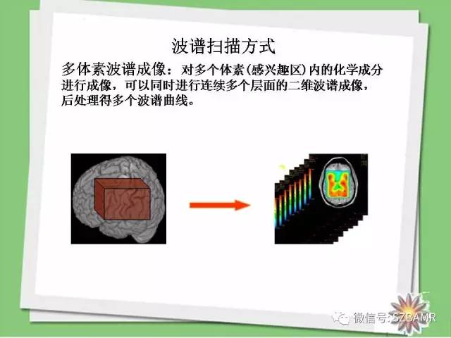 【PPT】波谱扫描技术及病例图片展示
