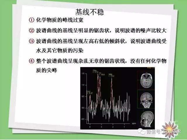 【PPT】波谱扫描技术及病例图片展示