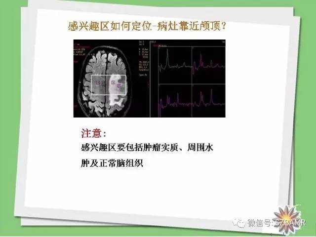【PPT】波谱扫描技术及病例图片展示