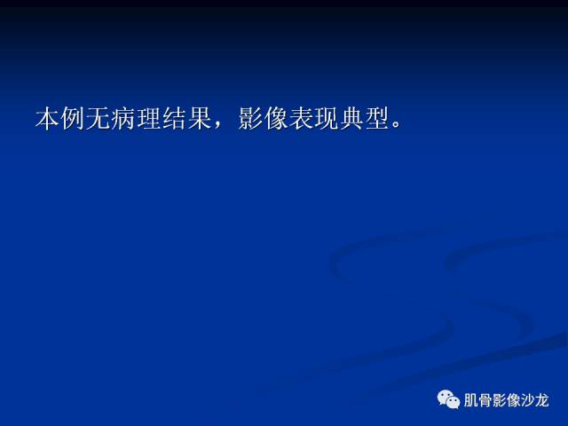 郎格汉斯组织细胞增生症(LCH)的影像学诊断 郎格汉斯组织细胞增生症(LCH)的影像学诊断