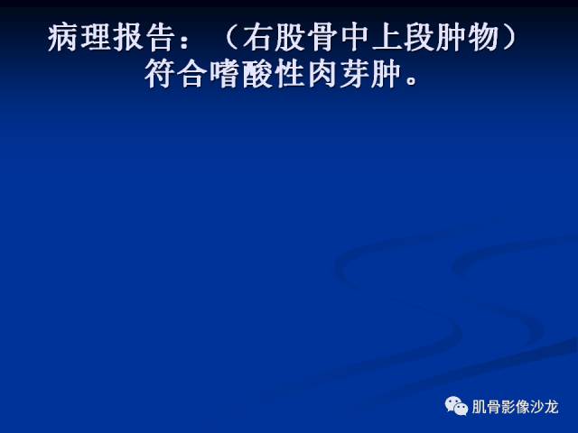 郎格汉斯组织细胞增生症(LCH)的影像学诊断 郎格汉斯组织细胞增生症(LCH)的影像学诊断