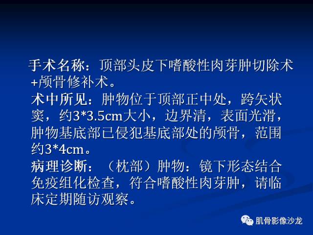 郎格汉斯组织细胞增生症(LCH)的影像学诊断 郎格汉斯组织细胞增生症(LCH)的影像学诊断
