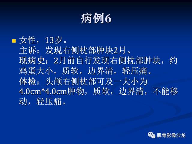 郎格汉斯组织细胞增生症(LCH)的影像学诊断 郎格汉斯组织细胞增生症(LCH)的影像学诊断