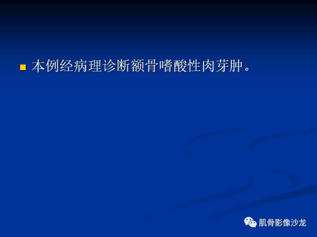 郎格汉斯组织细胞增生症(LCH)的影像学诊断 郎格汉斯组织细胞增生症(LCH)的影像学诊断