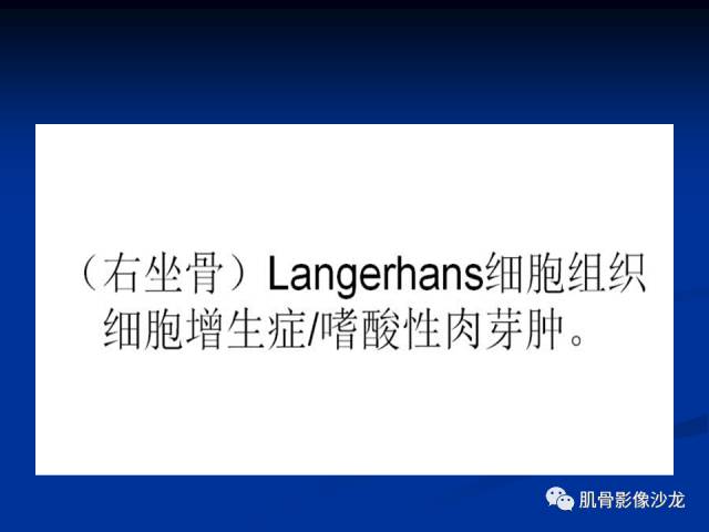 郎格汉斯组织细胞增生症(LCH)的影像学诊断 郎格汉斯组织细胞增生症(LCH)的影像学诊断