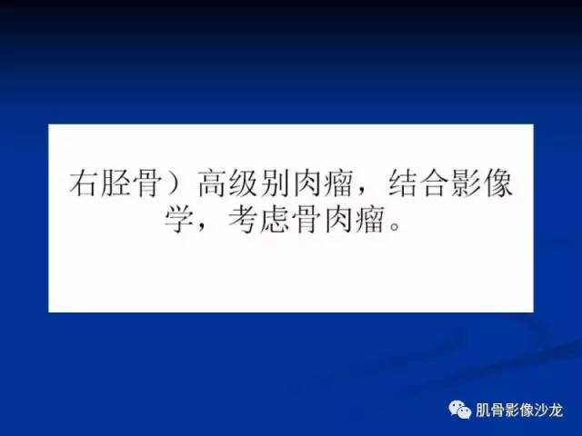 郎格汉斯组织细胞增生症(LCH)的影像学诊断 郎格汉斯组织细胞增生症(LCH)的影像学诊断