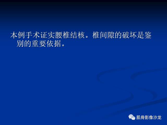 郎格汉斯组织细胞增生症(LCH)的影像学诊断 郎格汉斯组织细胞增生症(LCH)的影像学诊断