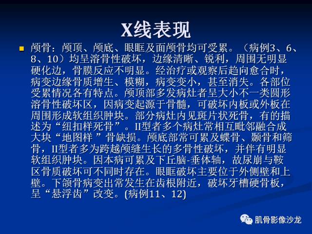 郎格汉斯组织细胞增生症(LCH)的影像学诊断 郎格汉斯组织细胞增生症(LCH)的影像学诊断