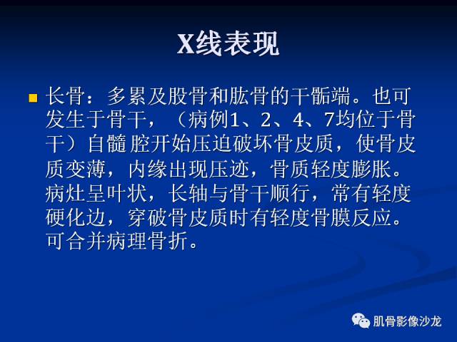 郎格汉斯组织细胞增生症(LCH)的影像学诊断 郎格汉斯组织细胞增生症(LCH)的影像学诊断