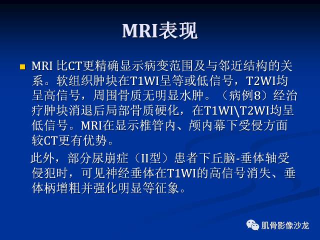 郎格汉斯组织细胞增生症(LCH)的影像学诊断 郎格汉斯组织细胞增生症(LCH)的影像学诊断