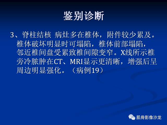 郎格汉斯组织细胞增生症(LCH)的影像学诊断 郎格汉斯组织细胞增生症(LCH)的影像学诊断