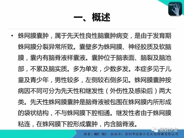 【病例】小儿后颅凹巨大蛛网膜囊肿1例MR