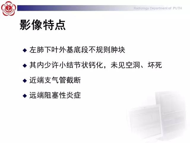 【病例】肺粘液表皮样癌1例CT
