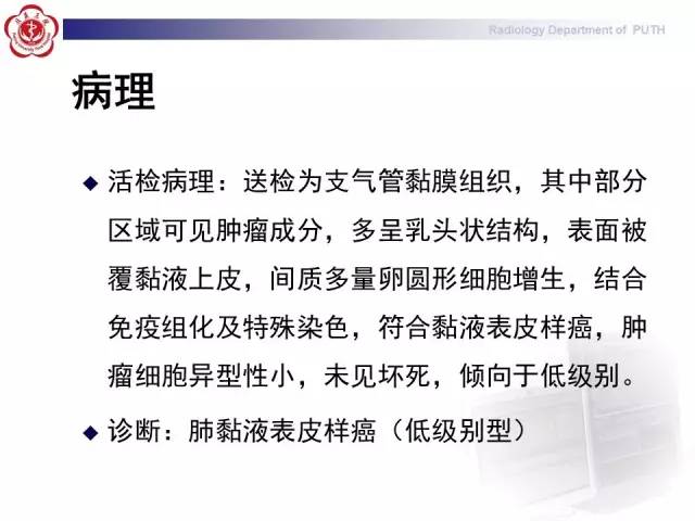 【病例】肺粘液表皮样癌1例CT