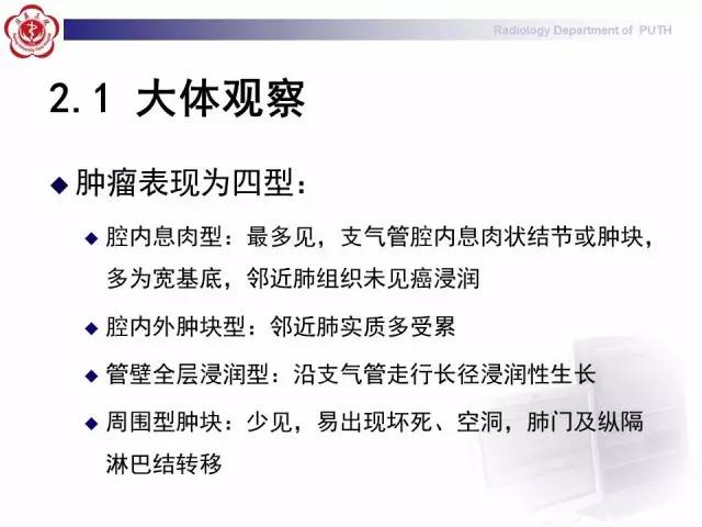 【病例】肺粘液表皮样癌1例CT