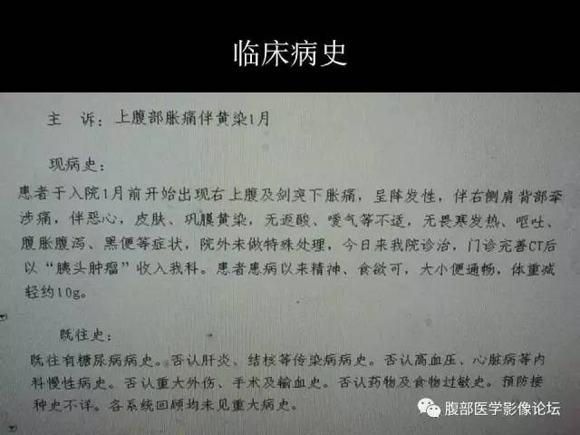 【病例】胰腺头部粘液腺癌1例CT影像表现