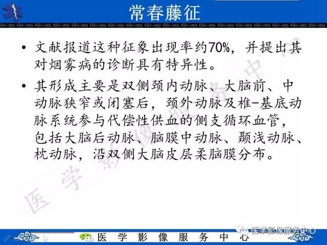 【影像征象】常春藤征