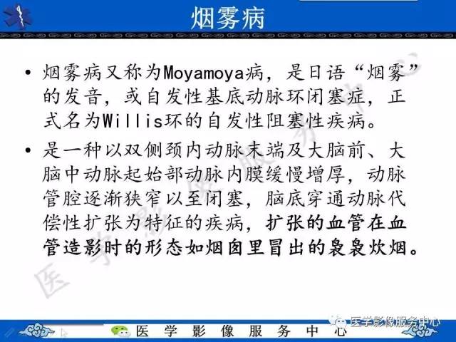 【影像征象】常春藤征