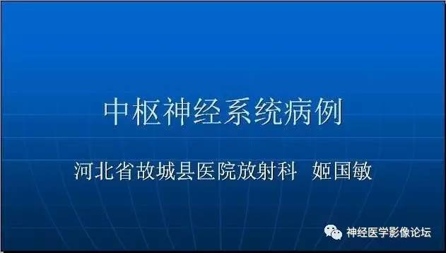 【病例】四脑室室管膜瘤1例MR 【病例】四脑室室管膜瘤1例MR
