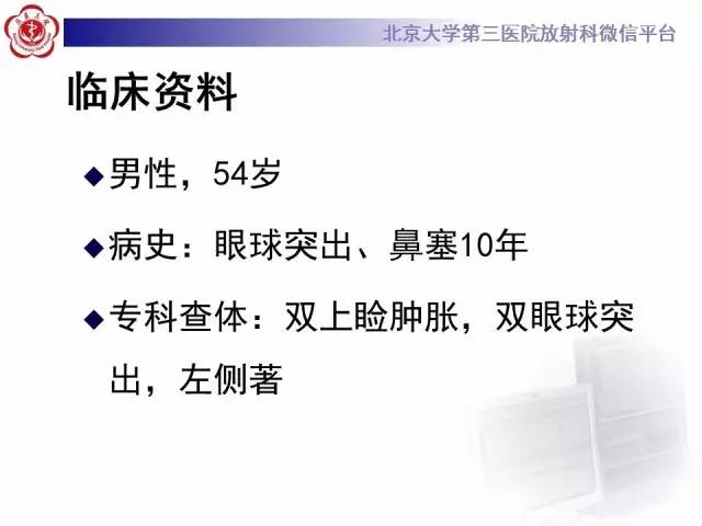 【病例】特发性眼眶炎性假瘤1例CT影像诊断
