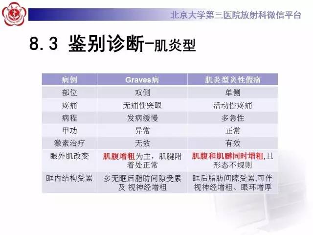 【病例】特发性眼眶炎性假瘤1例CT影像诊断
