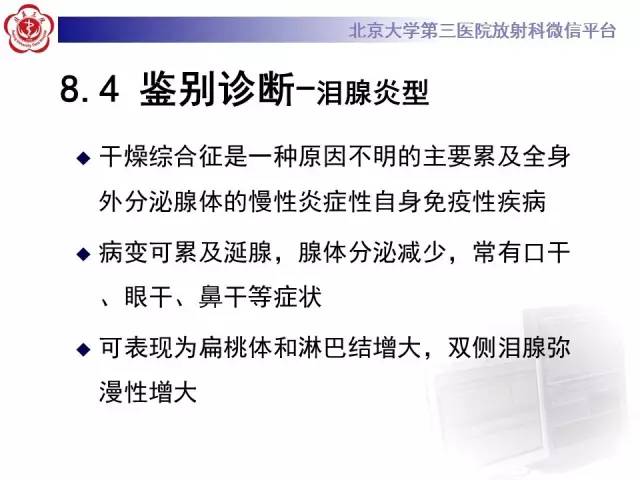【病例】特发性眼眶炎性假瘤1例CT影像诊断