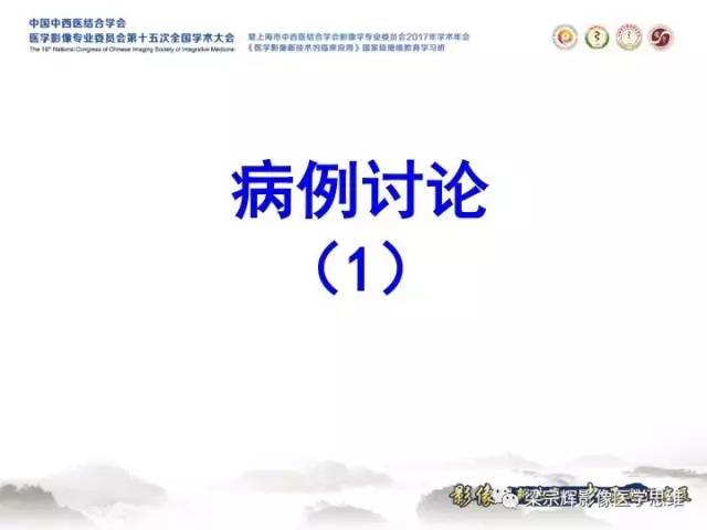【病例】甲状旁腺功能亢进棕色瘤1例X线CT