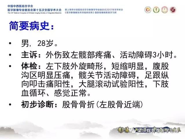 【病例】甲状旁腺功能亢进棕色瘤1例X线CT