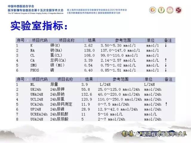 【病例】甲状旁腺功能亢进棕色瘤1例X线CT
