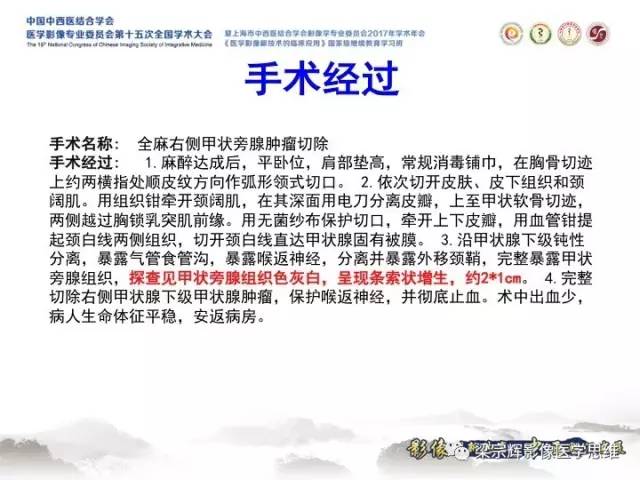 【病例】甲状旁腺功能亢进棕色瘤1例X线CT