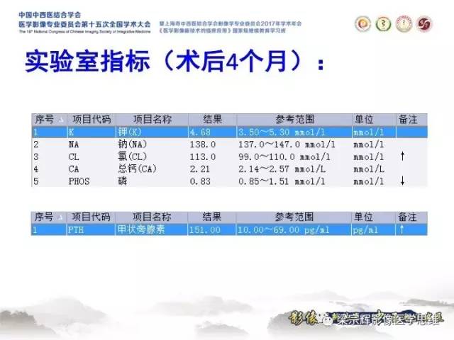 【病例】甲状旁腺功能亢进棕色瘤1例X线CT