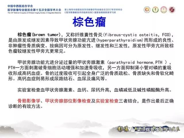 【病例】甲状旁腺功能亢进棕色瘤1例X线CT