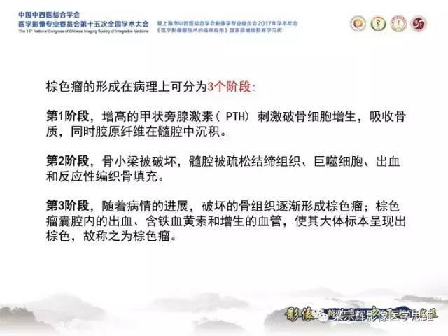 【病例】甲状旁腺功能亢进棕色瘤1例X线CT