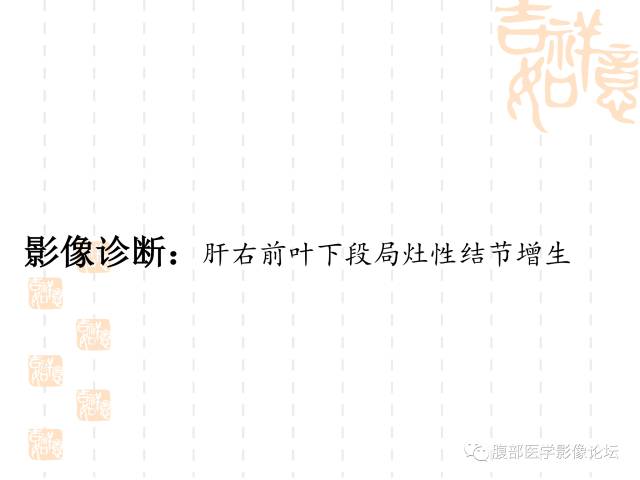 【病例】肝右叶局灶性结节性增生1例CT及MR影像表现
