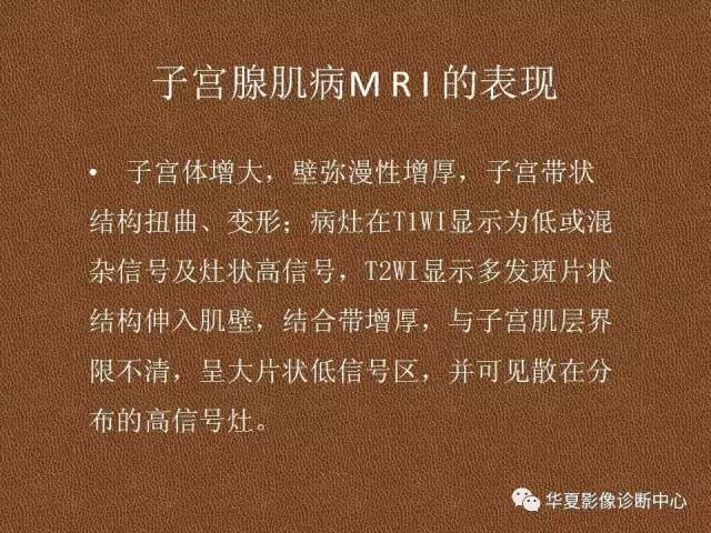 【PPT】子宫腺肌病