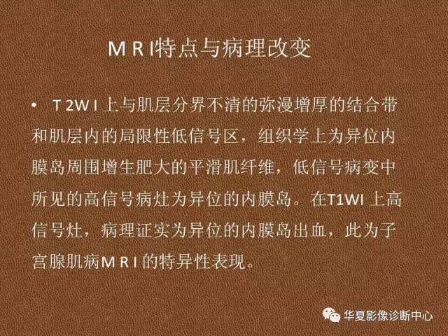 【PPT】子宫腺肌病