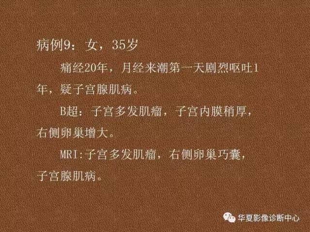 【PPT】子宫腺肌病