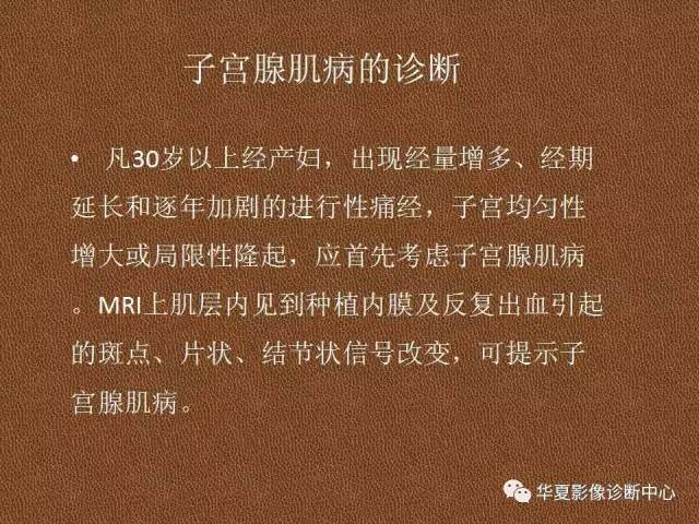 【PPT】子宫腺肌病