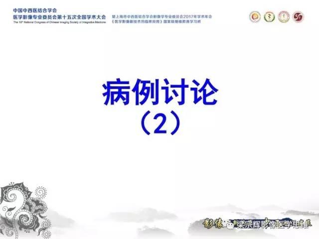 【病例】肝脏血管肌纤维母细胞瘤1例CT及MR