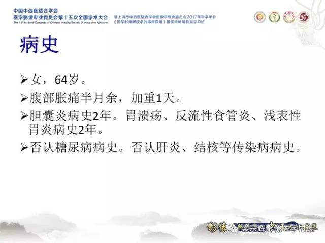【病例】肝脏血管肌纤维母细胞瘤1例CT及MR