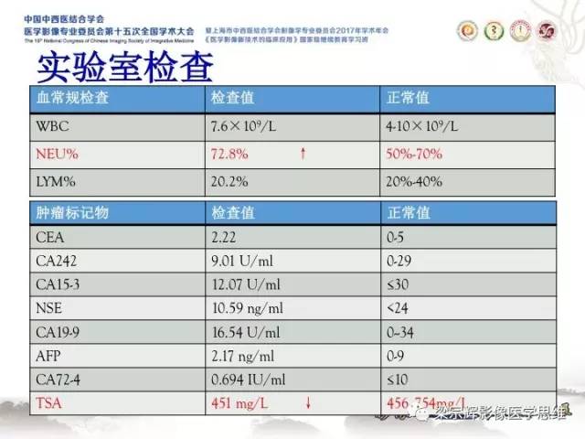 【病例】肝脏血管肌纤维母细胞瘤1例CT及MR
