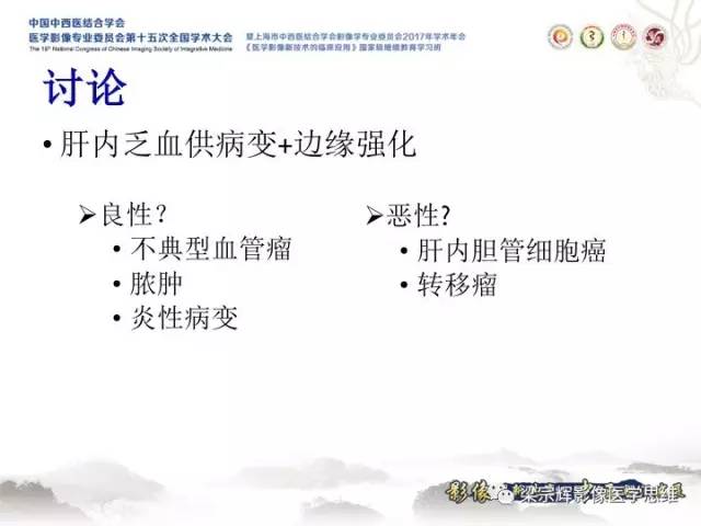 【病例】肝脏血管肌纤维母细胞瘤1例CT及MR