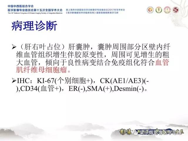 【病例】肝脏血管肌纤维母细胞瘤1例CT及MR