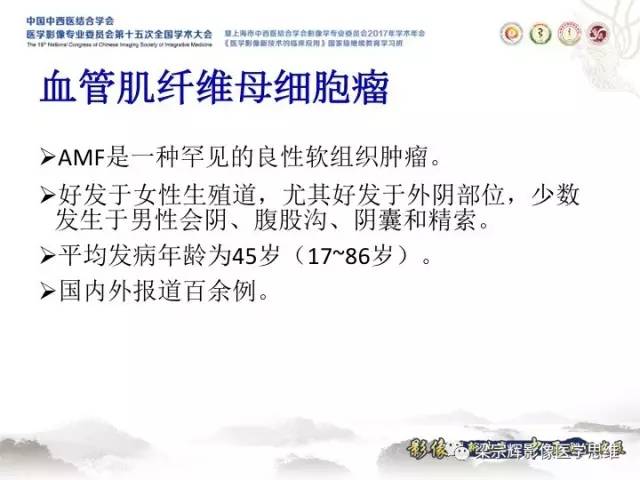 【病例】肝脏血管肌纤维母细胞瘤1例CT及MR