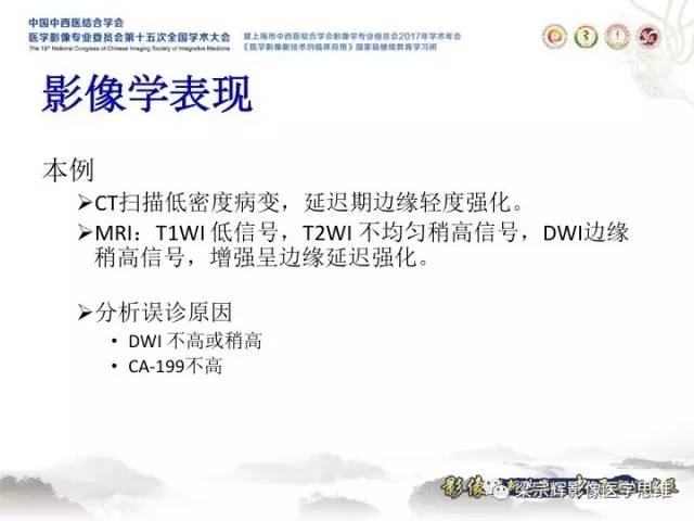 【病例】肝脏血管肌纤维母细胞瘤1例CT及MR