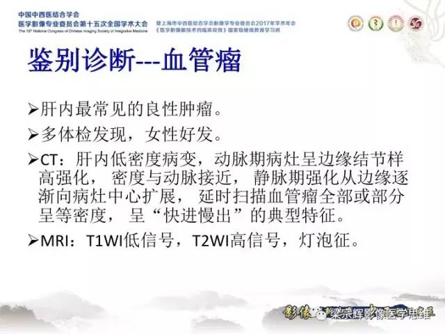 【病例】肝脏血管肌纤维母细胞瘤1例CT及MR